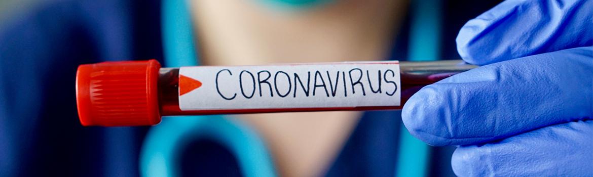 Leiderschap in de Coronacrisis – Wat kan de OR?